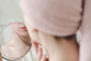 Azelaic Acid for Skin