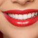 Whiten Teeth at Home