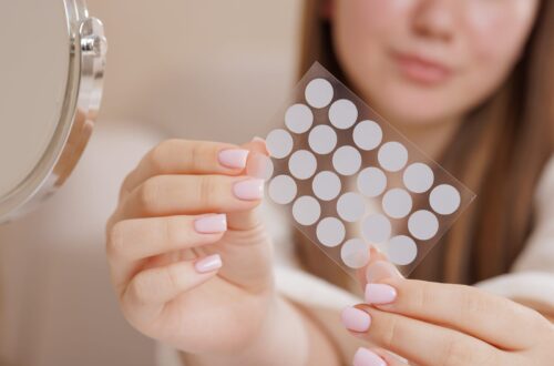 pimple patches